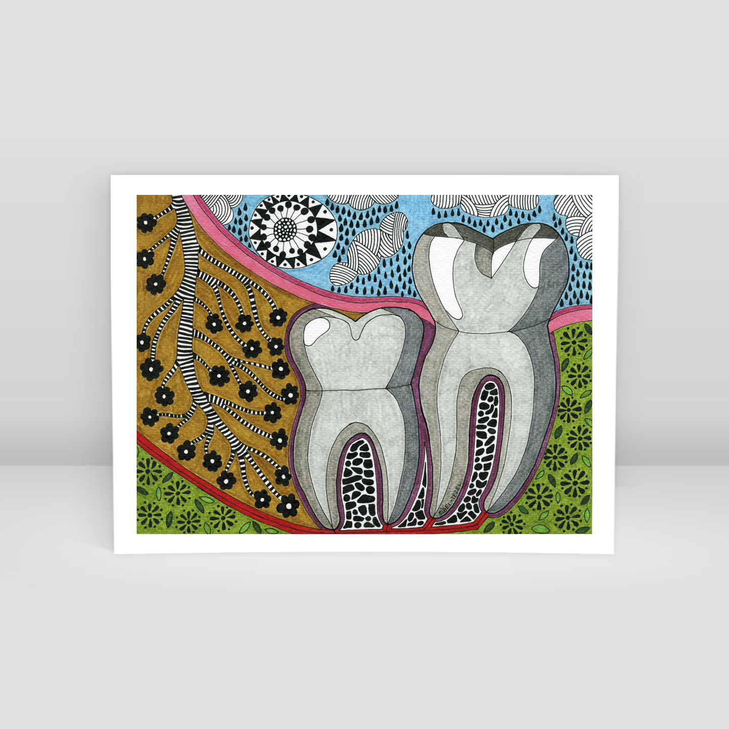 vertical impact wisdom tooth - Art Print