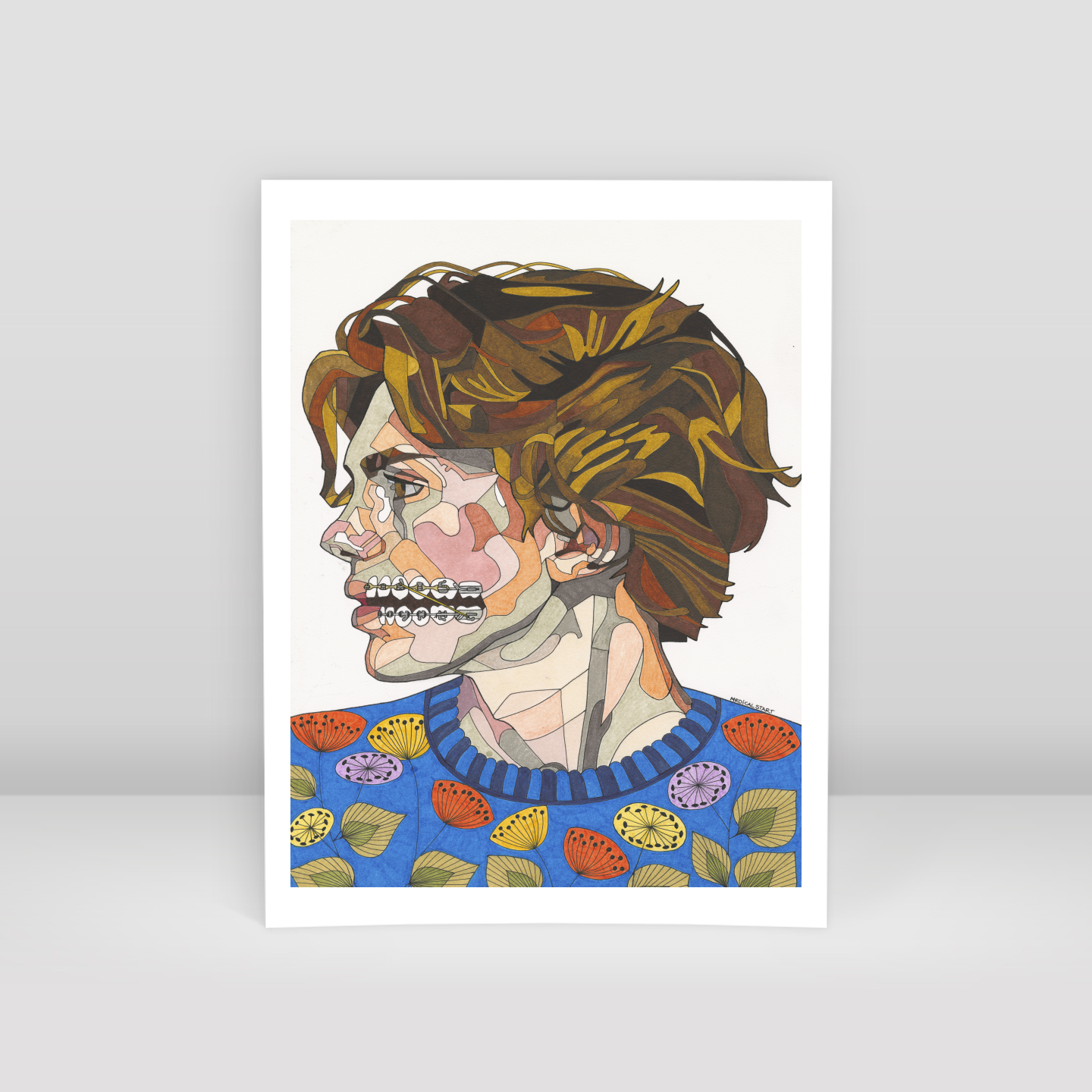 orthodontic treatment - Art Print