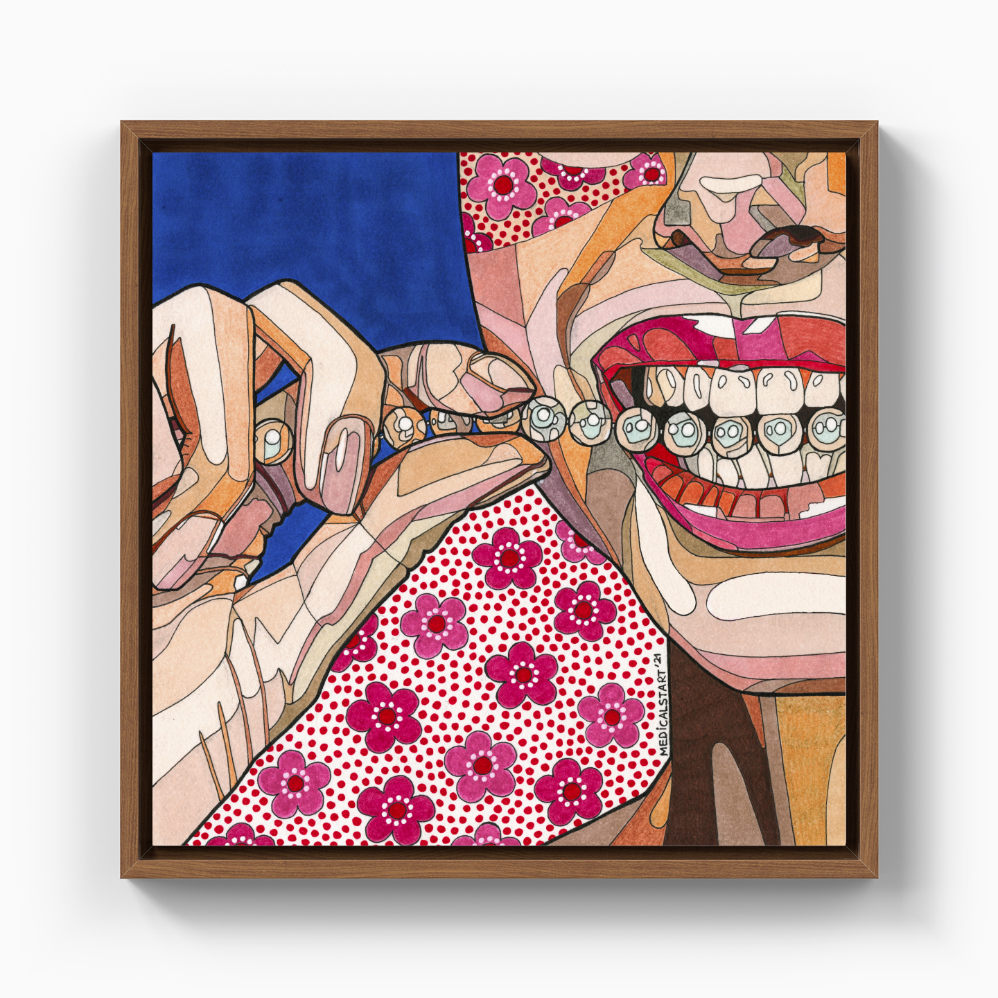 pearly teeth - Canvas Painting