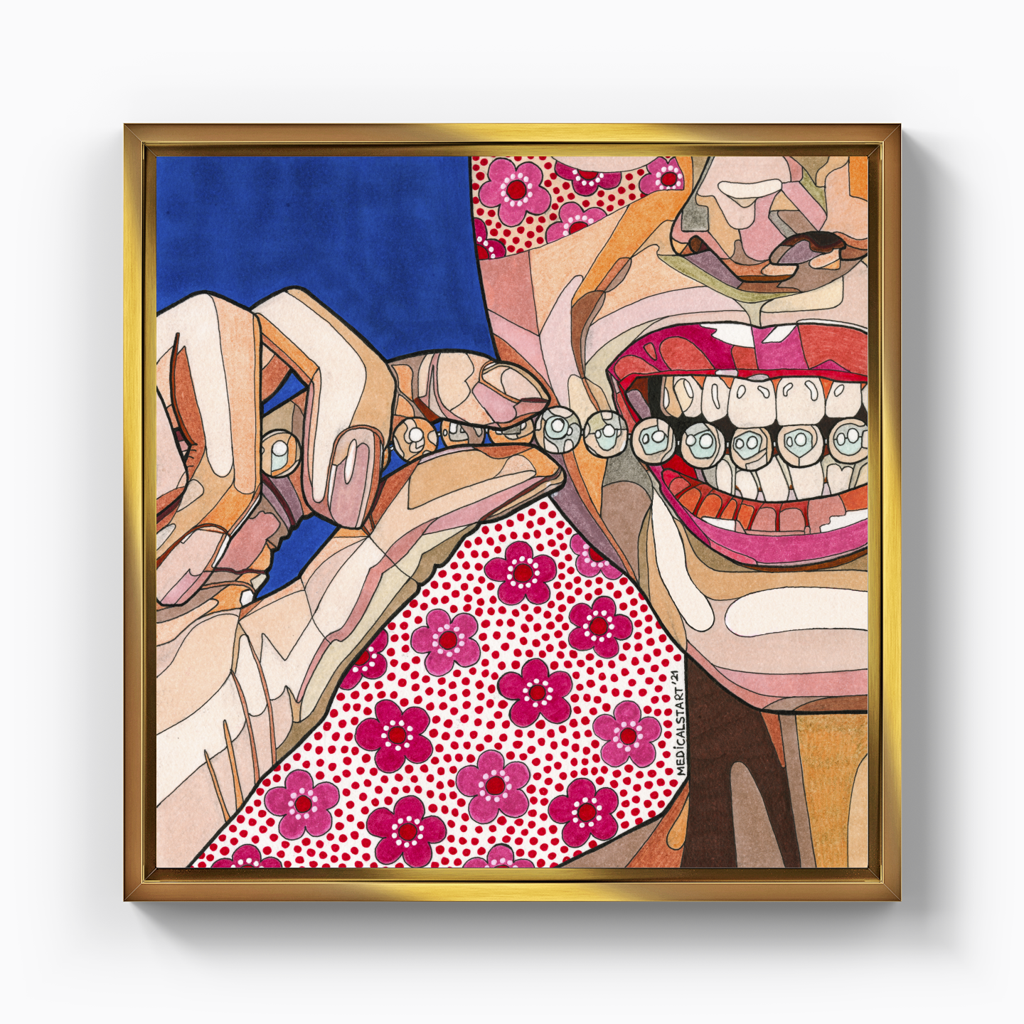 pearly teeth - Canvas Painting