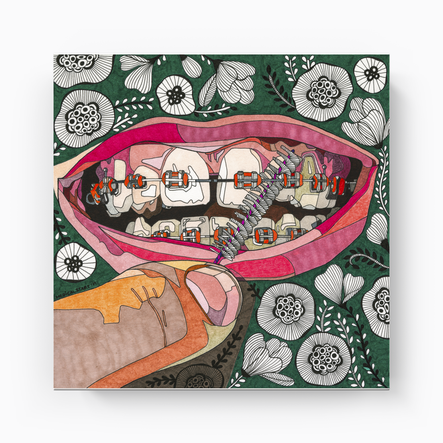 oral care in orthodontia - Canvas Print