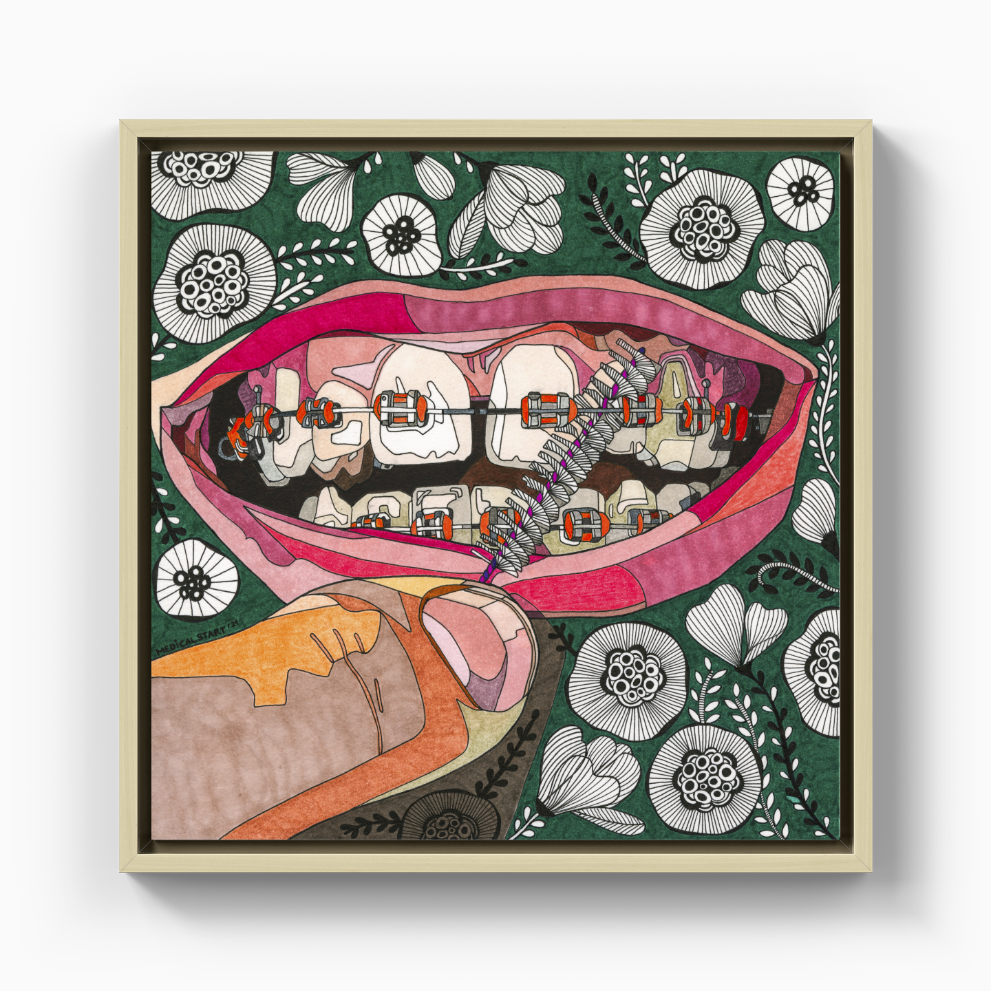 oral care in orthodontia - Canvas Print